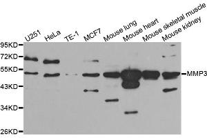 Western blot analysis of extracts of various cell lines, using MMP3 antibody (ABIN5970544) at 1/1000 dilution. (MMP3 anticorps)