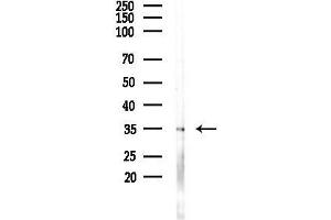 anti-Interferon gamma Receptor 2 (Interferon gamma Transducer 1) (IFNGR2) (C-Term) antibody