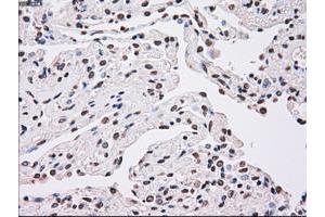 Image no. 1 for anti-Polo-Like Kinase 1 (PLK1) antibody (ABIN1500283)