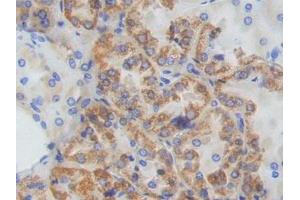 IHC-P analysis of Human Kidney Tissue, with DAB staining. (ADCY9 anticorps  (AA 1029-1282))