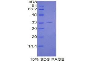 SDS-PAGE analysis of Human Karyopherin alpha 1 Protein. (KPNA1 Protéine)