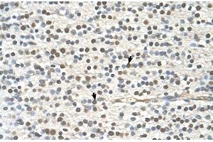 Human Brain (GAPVD1 anticorps  (N-Term))