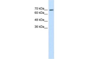 Western Blotting (WB) image for anti-EPS8-Like 1 (EPS8L1) antibody (ABIN2462593) (EPS8-Like 1 anticorps)