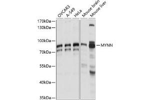 Western blot analysis of extracts of various cell lines, using MYNN antibody (ABIN7268741) at 1:1000 dilution. (Myoneurin anticorps  (AA 1-300))