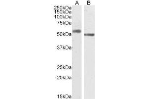 ABIN570915 (2µg/ml) staining of Human Adrenal Gland (A) and Mouse Brain (B) lysate (35µg protein in RIPA buffer).