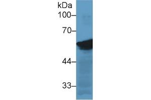 Detection of VIM in Human Hela cell lysate using Monoclonal Antibody to Vimentin (VIM)