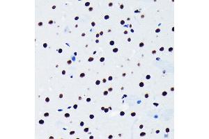 Immunohistochemistry of paraffin-embedded mouse brain using TDP-43/TARDB Rabbit mAb (ABIN7270730) at dilution of 1:100 (40x lens). (TARDBP anticorps)