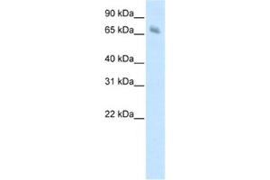 Western Blotting (WB) image for anti-Kelch-like protein 41 (KLHL41) antibody (ABIN2461775) (Kelch-like protein 41 (KLHL41) anticorps)