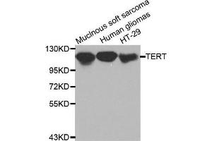 Western blot analysis of extracts of various cell lines, using TERT antibody. (TERT anticorps  (C-Term))
