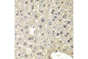 Immunohistochemistry of paraffin-embedded mouse liver using NR3C1 antibody. (Glucocorticoid Receptor anticorps)