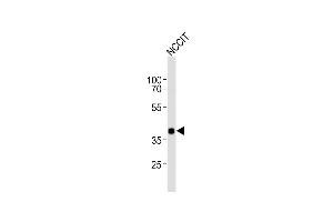Anti-DA4 Antibody (Center) at 1:1000 dilution + NCCIT whole cell lysates Lysates/proteins at 20 μg per lane. (DPPA4 anticorps  (AA 107-142))