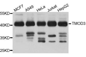 Western Blotting (WB) image for anti-Tropomodulin 3 (TMOD3) (AA 1-352) antibody (ABIN1683055) (TMOD3 anticorps  (AA 1-352))
