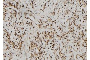 ABIN6279761 at 1/100 staining Human gastric tissue by IHC-P. (RFPL2 anticorps)