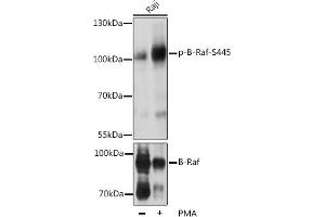 Western blot analysis of extracts of Raji cells, using Phospho-B-Raf-S445 pAb (ABIN3019431, ABIN3019432, ABIN3019433, ABIN1681422 and ABIN6225367) at 1:2000 dilution or BRAF antibody (ABIN6131244, ABIN6137637, ABIN6137639 and ABIN6213593). (BRAF anticorps  (pSer445))