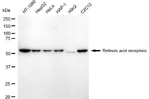 Western blotting analysis using Retinoic acid receptor alpha antibody (ABIN7800189). (Recombinant Retinoic Acid Receptor alpha anticorps)