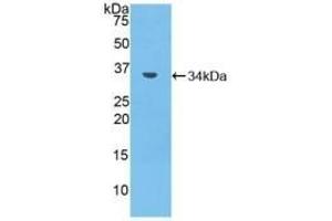 Detection of Recombinant MMP7, Mouse using Polyclonal Antibody to Matrix Metalloproteinase 7 (MMP7)