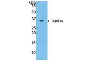 Detection of Recombinant MMP7, Mouse using Polyclonal Antibody to Matrix Metalloproteinase 7 (MMP7) (MMP7 anticorps  (AA 1-264))