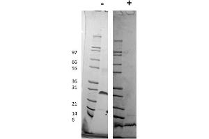SDS-PAGE of Human Platelet Derived Growth Factor-BB Recombinant Protein SDS-PAGE of Human Platelet Derived Growth Factor-BB Recombinant Protein. (PDGF-BB Homodimer Protéine)