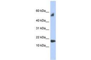 Image no. 1 for anti-Testis Expressed 19 (TEX19) (C-Term) antibody (ABIN6743950) (TEX19 anticorps  (C-Term))