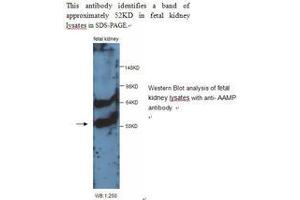 Image no. 1 for anti-Angio-Associated, Migratory Cell Protein (AAMP) antibody (ABIN790850) (AAMP anticorps)