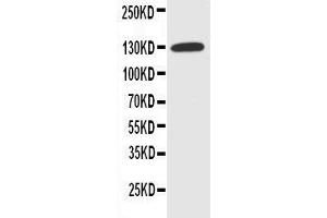 Anti-NKCC1 antibody, Western blotting WB: HELA Cell Lysate
