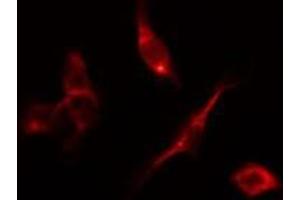 anti-Death-Associated Protein Kinase 2 (DAPK2) (C-Term) antibody