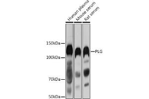 Western blot analysis of extracts of various cell lines, using PLG antibody (ABIN1682202, ABIN3017690, ABIN3017692 and ABIN6220212) at 1:1000 dilution.