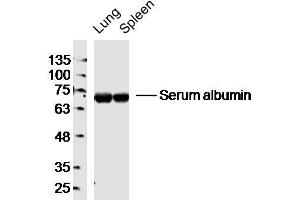 Lane 1: Mouse Lung lysates Lane 2: Mouse Spleen lysates probed with Serum albumin Polyclonal Antibody, Unconjugated  at 1:300 dilution and 4˚C overnight incubation. (Albumin anticorps)