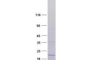Validation with Western Blot