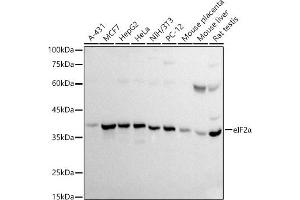 Western blot analysis of extracts of various cell lines, using eIF2α antibody (ABIN3021126, ABIN3021127, ABIN5663762 and ABIN6213983) at 1:500 dilution. (EIF2S1 anticorps  (AA 1-260))