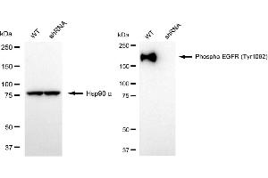 Western blotting analysis using phospho-EGFR (Tyr) antibody (ABIN7798465).