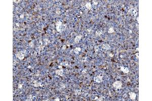 IHC analysis of NOXA2/p67phox/NCF2 using anti-NOXA2/p67phox/NCF2 antibody (ABIN7599462). (NCF2 anticorps  (AA 1-526))