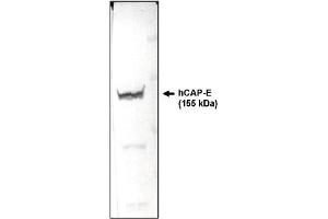 Western Blotting (WB) image for anti-Structural Maintenance of Chromosomes 2 (SMC2) (AA 523-768) antibody (ABIN264446) (SMC2 anticorps  (AA 523-768))
