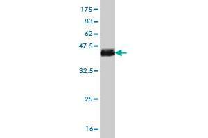 Western Blot detection against Immunogen (37.