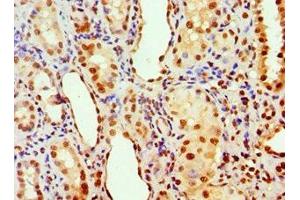 Immunohistochemistry of paraffin-embedded human kidney tissue using ABIN7143011 at dilution of 1:100 (PHAP1 anticorps  (AA 1-170))