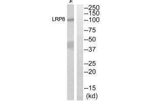 Western blot analysis of extracts from Jurkat cells, using LRP8 antibody. (LRP8 anticorps  (Internal Region))