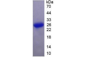 Image no. 1 for Suppressor of Cytokine Signaling 3 (SOCS3) (AA 1-225) (Active) protein (His tag) (ABIN6239899) (SOCS3 Protein (AA 1-225) (His tag))