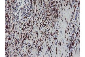 Image no. 11 for anti-Coagulation Factor XIII, A1 Polypeptide (F13A1) antibody (ABIN1498150)