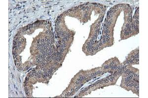 Image no. 5 for anti-Ubiquitin-Conjugating Enzyme E2G 2 (UBE2G2) antibody (ABIN1501631)