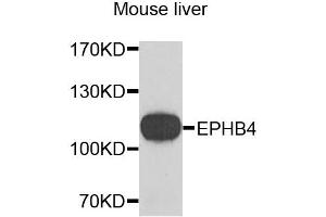Western blot analysis of extracts of mouse liver, using EPHB4 antibody. (EPH Receptor B4 anticorps)