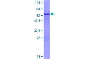 Image no. 1 for phosphoribosyl Pyrophosphate Synthetase-Associated Protein 2 (PRPSAP2) (AA 1-369) protein (GST tag) (ABIN1316423)