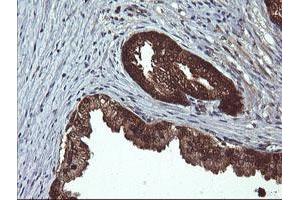 Image no. 7 for anti-D-Dopachrome Tautomerase (DDT) antibody (ABIN1497795)