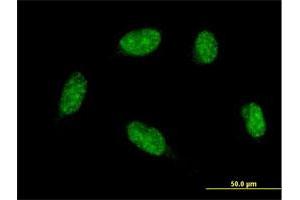 Immunofluorescence of monoclonal antibody to ATOH1 on HeLa cell. (ATOH1 anticorps  (AA 266-354))