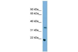 Western Blot showing Sohlh1 antibody used at a concentration of 1-2 ug/ml to detect its target protein. (SOHLH1 anticorps  (Middle Region))