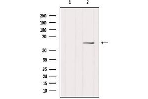 Western blot analysis of extracts from Hela, using Coilin Antibody. (Coilin anticorps  (Internal Region))