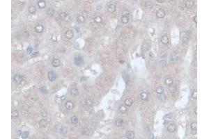 DAB staining on IHC-P; Samples: Rat Liver Tissue) (ORM1 anticorps  (AA 19-186))