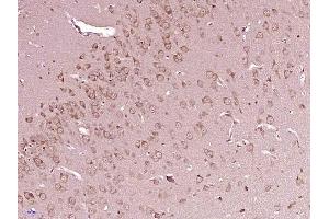 Paraformaldehyde-fixed, paraffin embedded rat brain, Antigen retrieval by boiling in sodium citrate buffer (pH6) for 15min, Block endogenous peroxidase by 3% hydrogen peroxide for 30 minutes, Blocking buffer (normal goat serum) at 37°C for 20min, Antibody incubation with SRC Polyclonal Antibody, Unconjugated  at 1:400 overnight at 4°C, followed by a conjugated secondary and DAB staining.