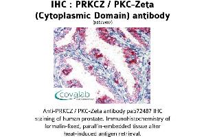 Image no. 1 for anti-Protein Kinase C, zeta (PRKCZ) (1st Cytoplasmic Domain) antibody (ABIN1738343) (PKC zeta anticorps  (1st Cytoplasmic Domain))