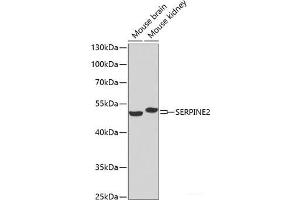 Western blot analysis of extracts of various cell lines using SERPINE2 Polyclonal Antibody at dilution of 1:1000. (SERPINE2 anticorps)