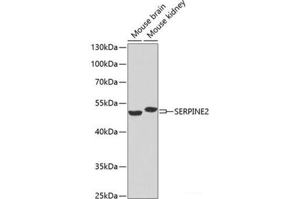 SERPINE2 抗体